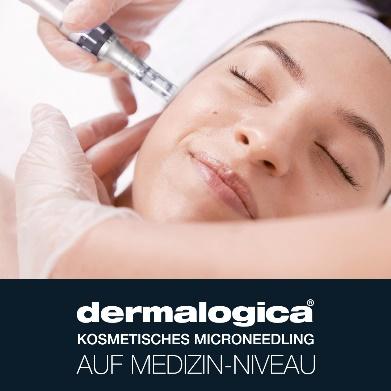 Microneedling